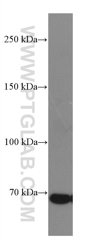 Western Blot (WB) analysis of K-562 cells using DR6 Monoclonal antibody (66754-1-Ig)