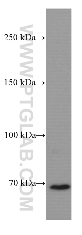 Western Blot (WB) analysis of Jurkat cells using DR6 Monoclonal antibody (66754-1-Ig)