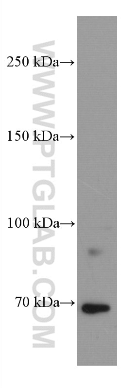 Western Blot (WB) analysis of Daudi cells using DR6 Monoclonal antibody (66754-1-Ig)