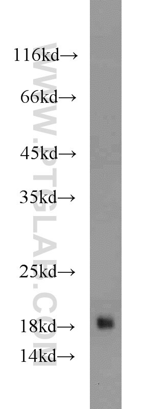 WB analysis of mouse thymus using 55397-1-AP