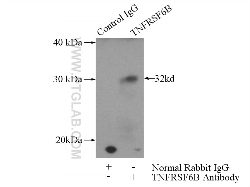 Immunoprecipitation (IP) experiment of HeLa cells using TNFRSF6B Polyclonal antibody (24999-1-AP)