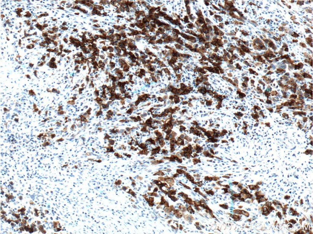 CD30/TNFRSF8