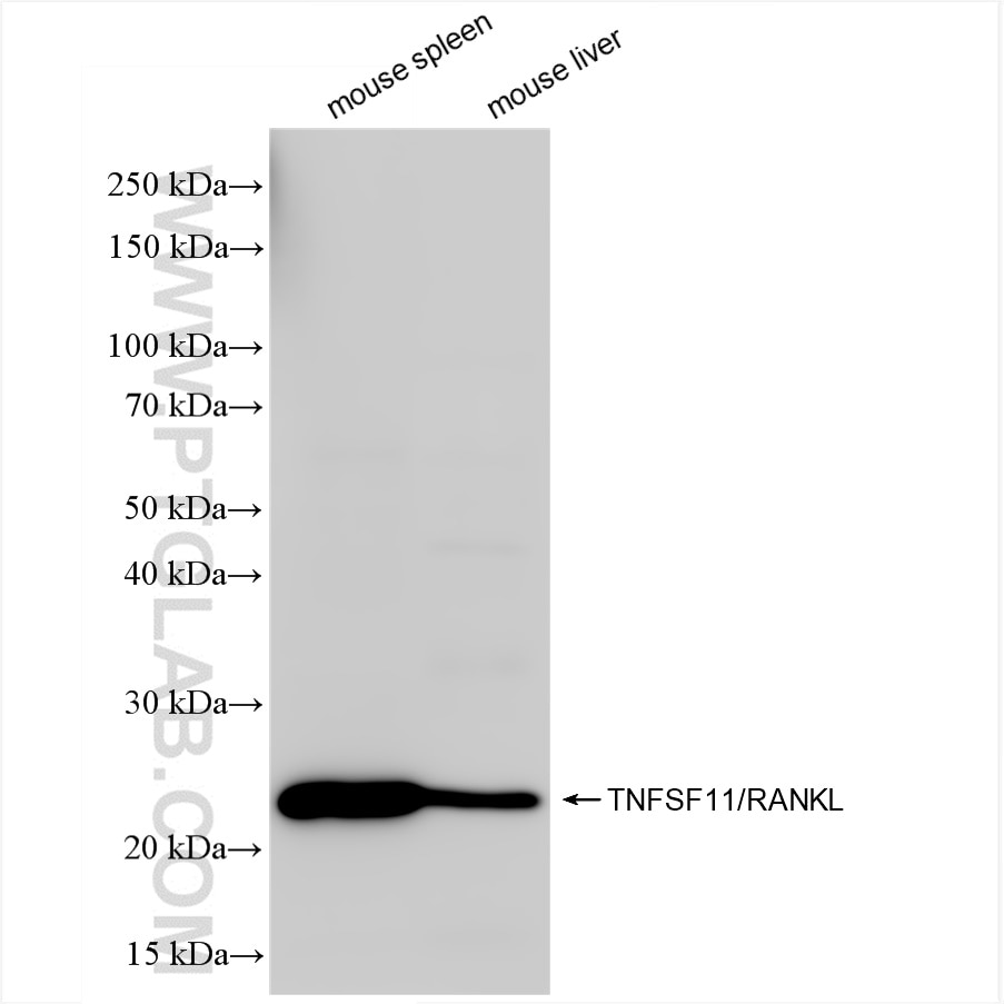 Western Blot (WB) analysis of various lysates using TNFSF11 Recombinant antibody (84431-5-RR)