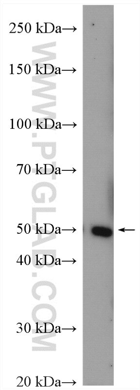 WB analysis of mouse testis using 11862-1-AP