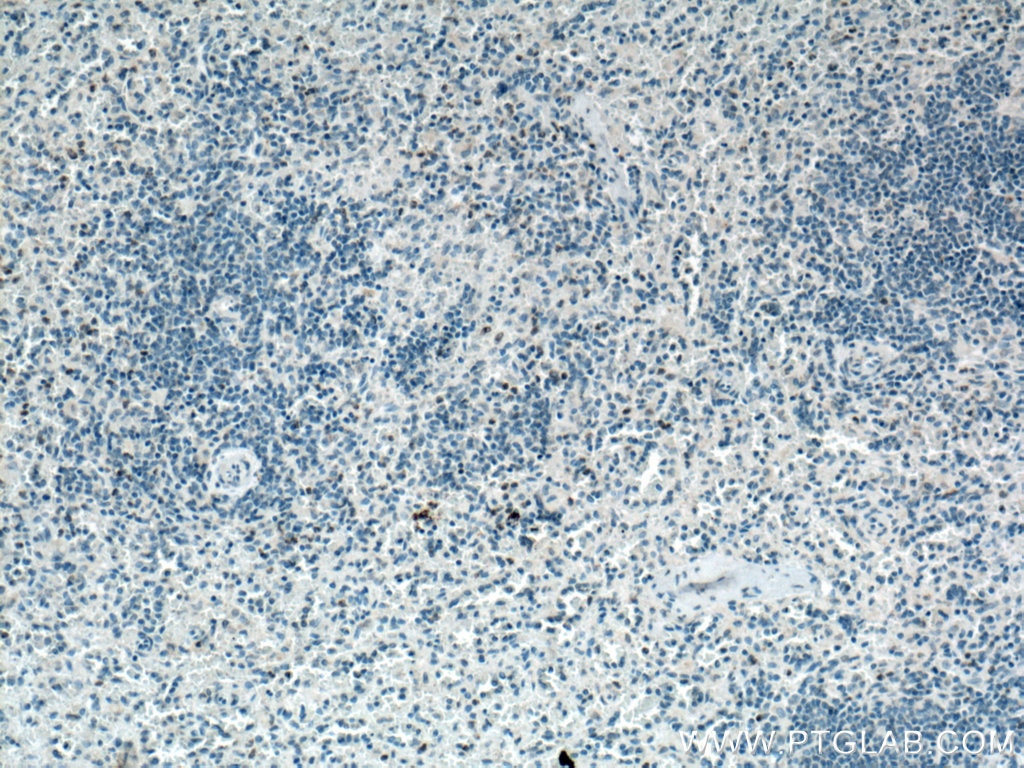 Immunohistochemistry (IHC) staining of human spleen tissue using LIGHT Polyclonal antibody (14194-1-AP)