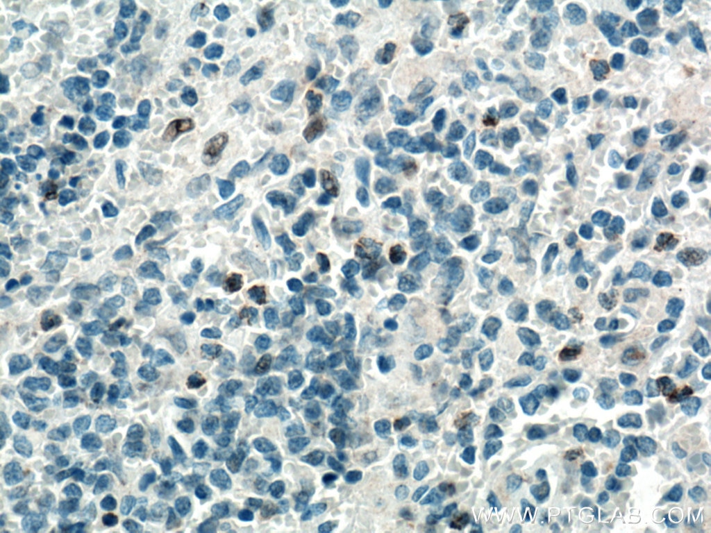 Immunohistochemistry (IHC) staining of human spleen tissue using LIGHT Polyclonal antibody (14194-1-AP)
