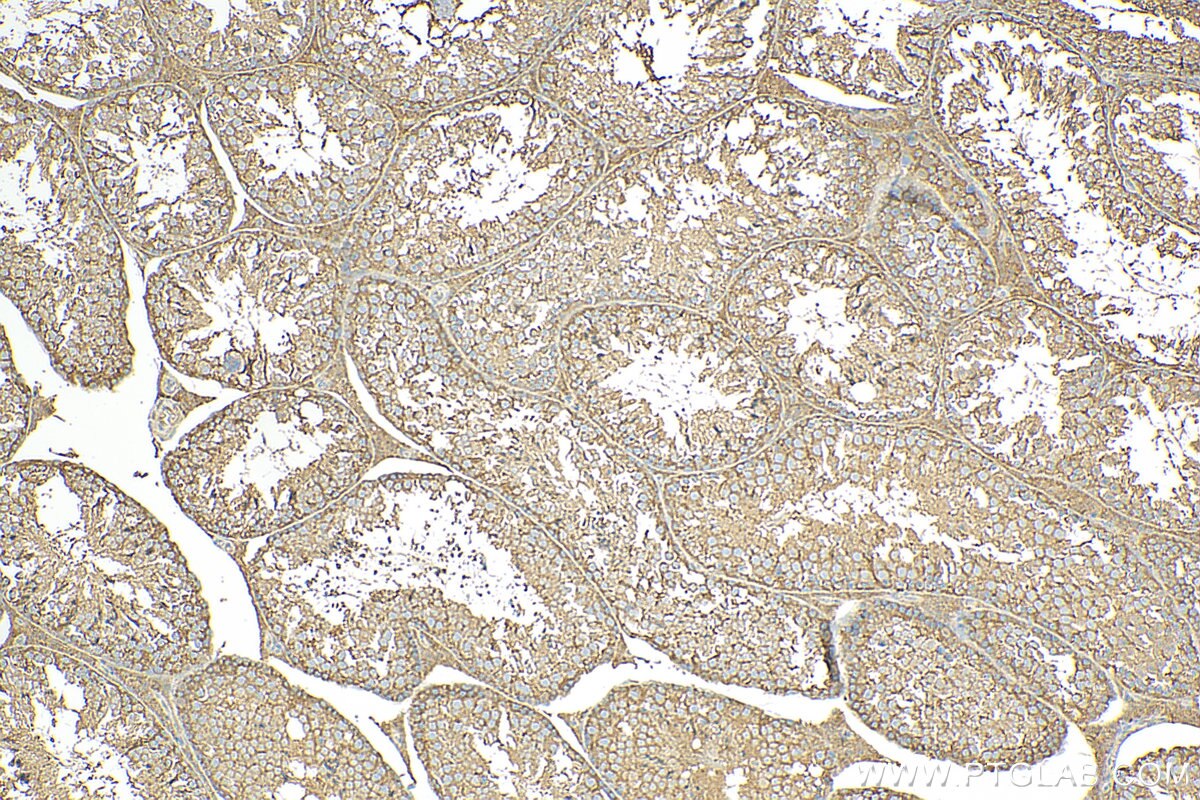 Immunohistochemistry (IHC) staining of mouse testis tissue using TNFSF18 Polyclonal antibody (23899-1-AP)