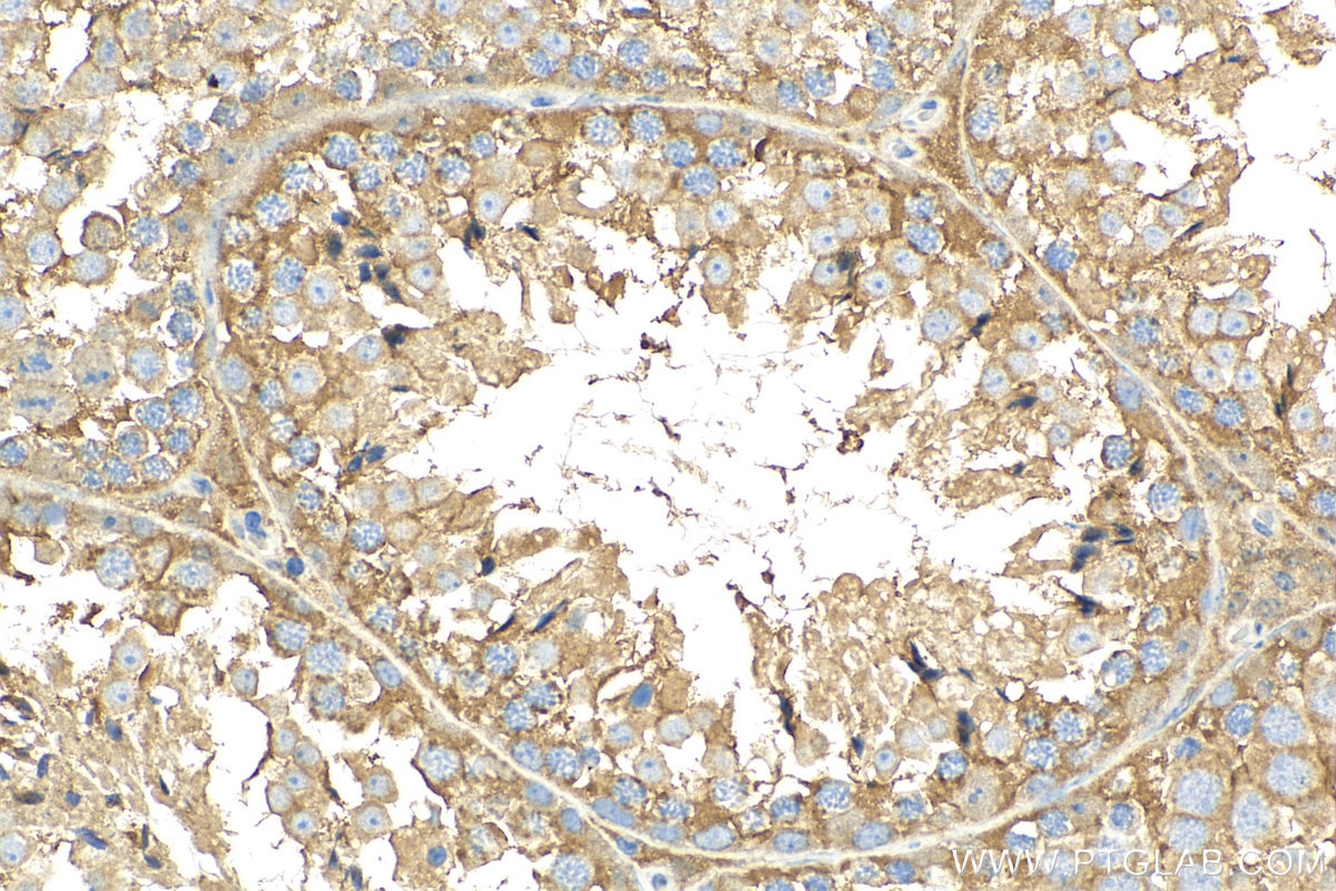 Immunohistochemistry (IHC) staining of mouse testis tissue using TNFSF18 Polyclonal antibody (23899-1-AP)