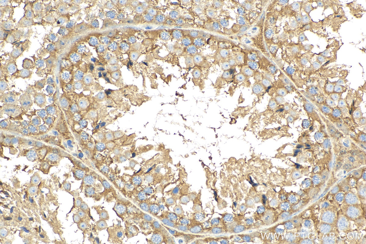 IHC staining of mouse testis using 23899-1-AP