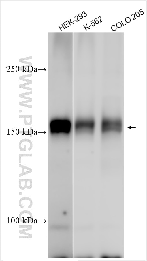 Western Blot (WB) analysis of various lysates using TNIK Polyclonal antibody (13955-1-AP)