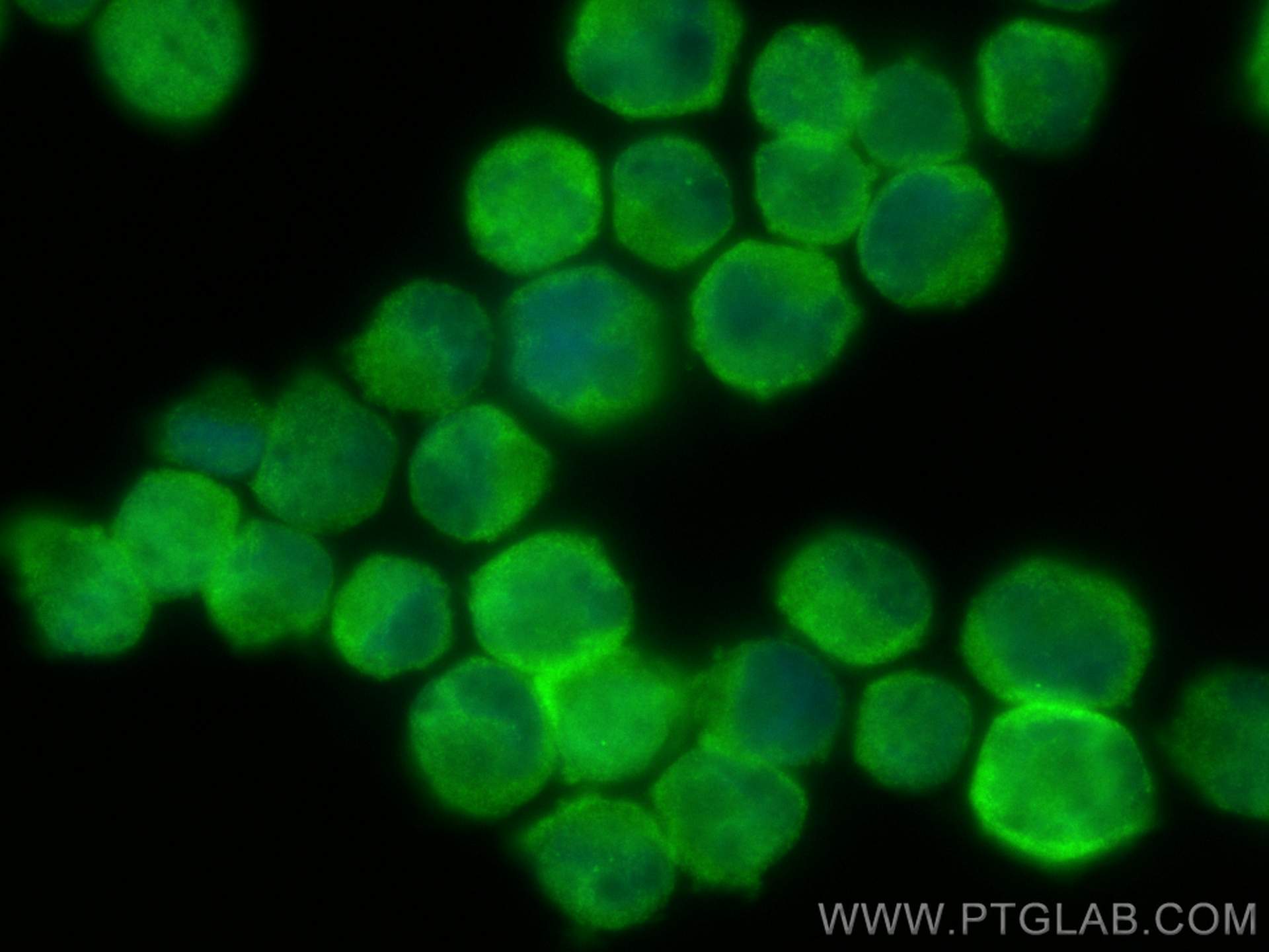 Immunofluorescence (IF) / fluorescent staining of K-562 cells using TNIK Polyclonal antibody (30906-1-AP)