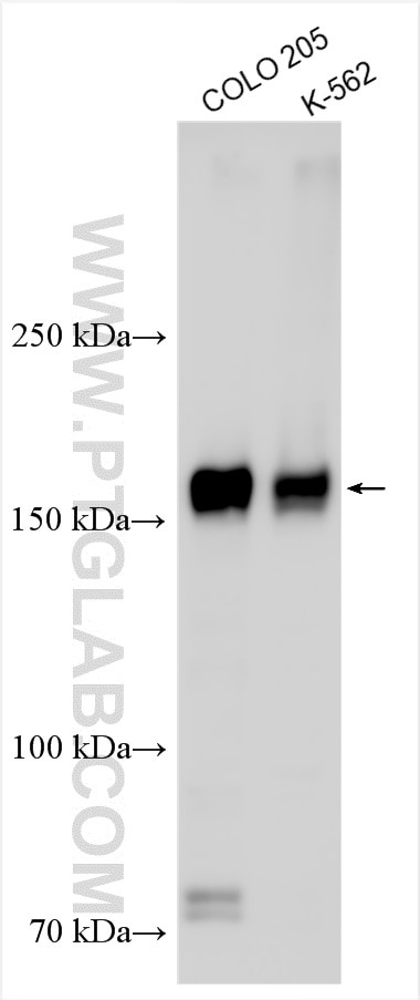 Western Blot (WB) analysis of various lysates using TNIK Polyclonal antibody (30906-1-AP)