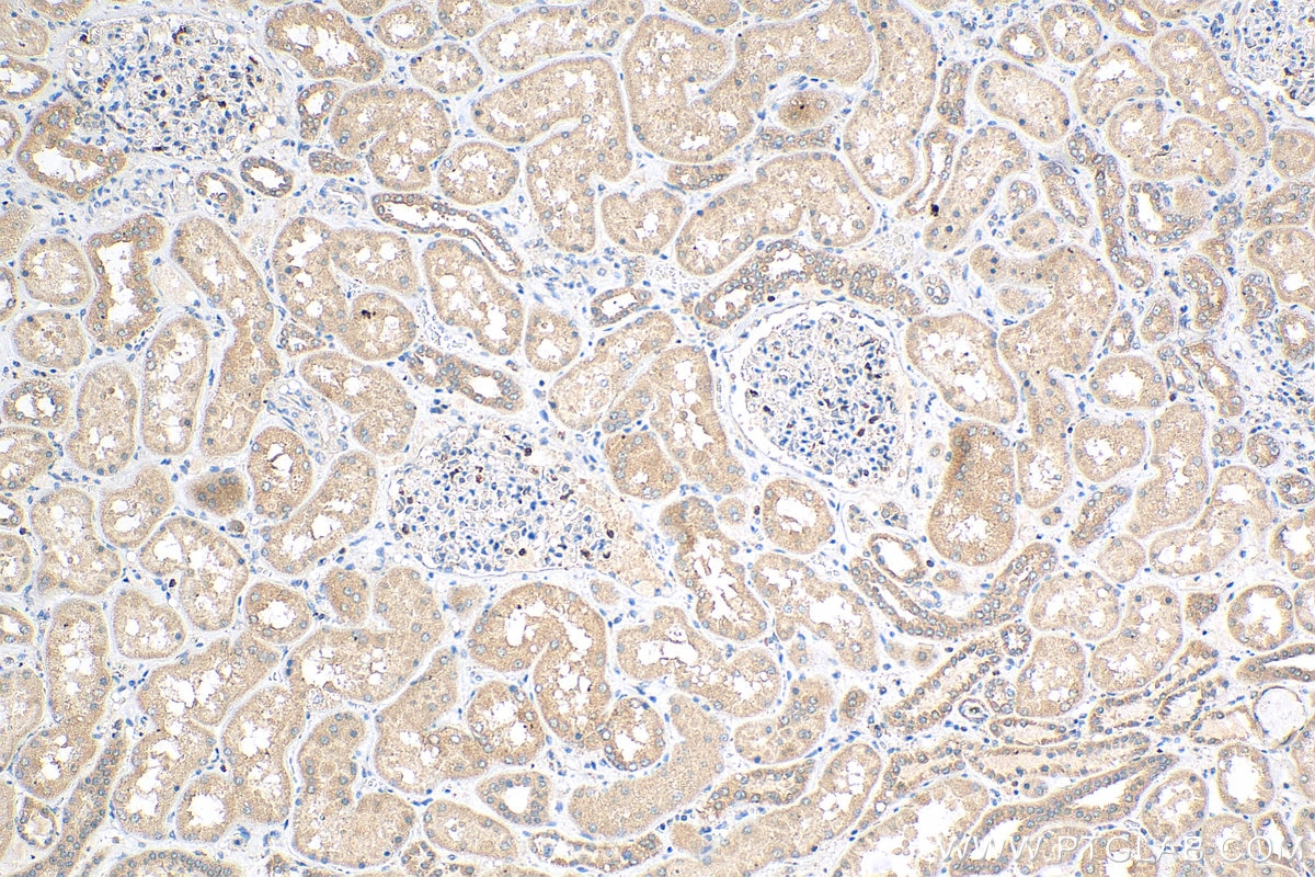 Immunohistochemistry (IHC) staining of human kidney tissue using TNIK Monoclonal antibody (67948-1-Ig)