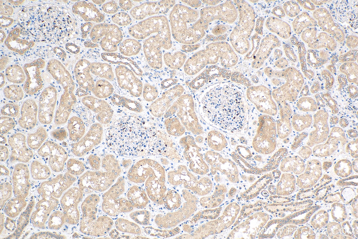 Immunohistochemistry (IHC) staining of human kidney tissue using TNIK Monoclonal antibody (67948-1-Ig)