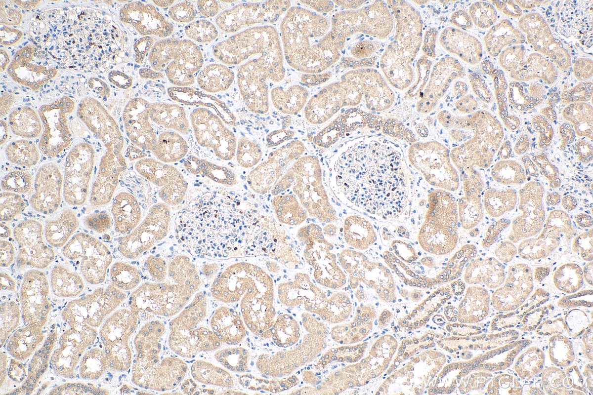 IHC staining of human kidney using 67948-1-Ig