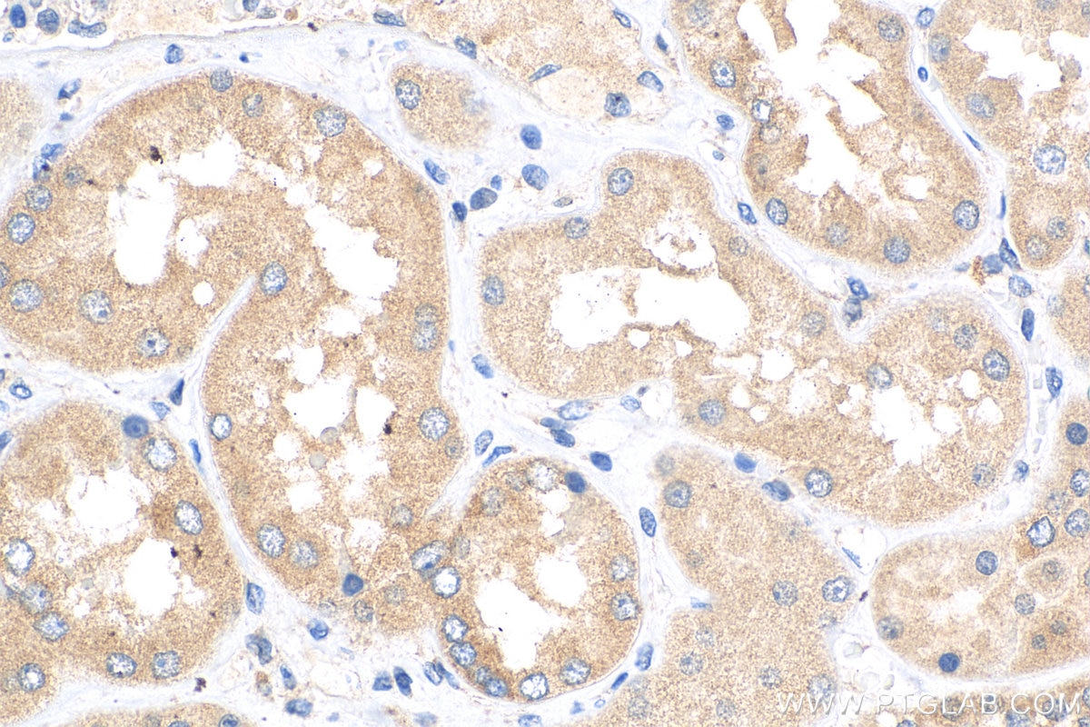 Immunohistochemistry (IHC) staining of human kidney tissue using TNIK Monoclonal antibody (67948-1-Ig)