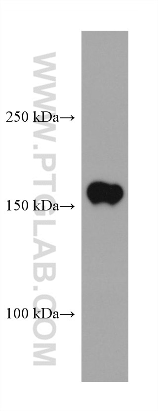 Western Blot (WB) analysis of human peripheral blood platelets using TNIK Monoclonal antibody (67948-1-Ig)