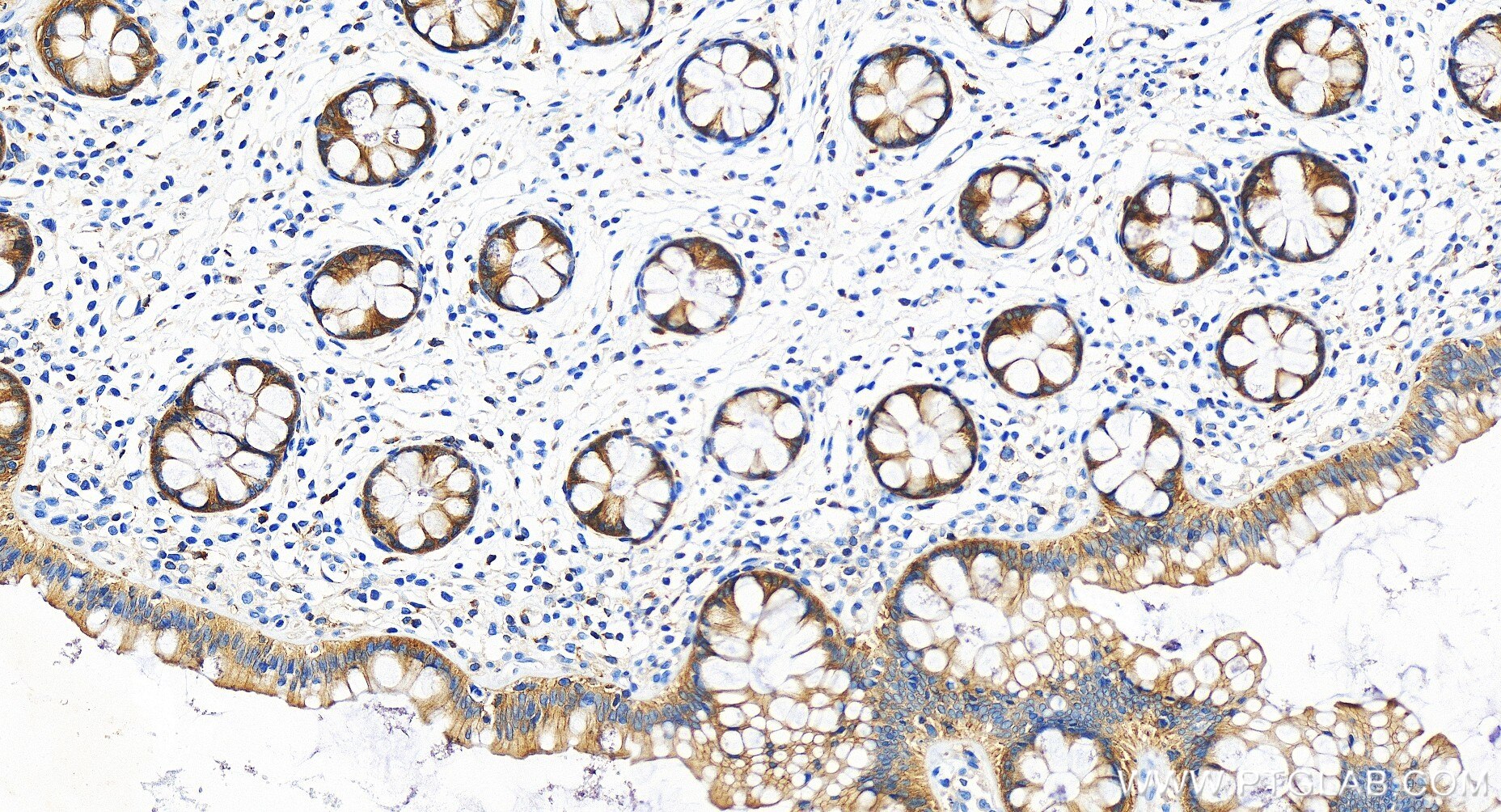 Immunohistochemistry (IHC) staining of human colon tissue using TNIK Recombinant antibody (84231-4-RR)