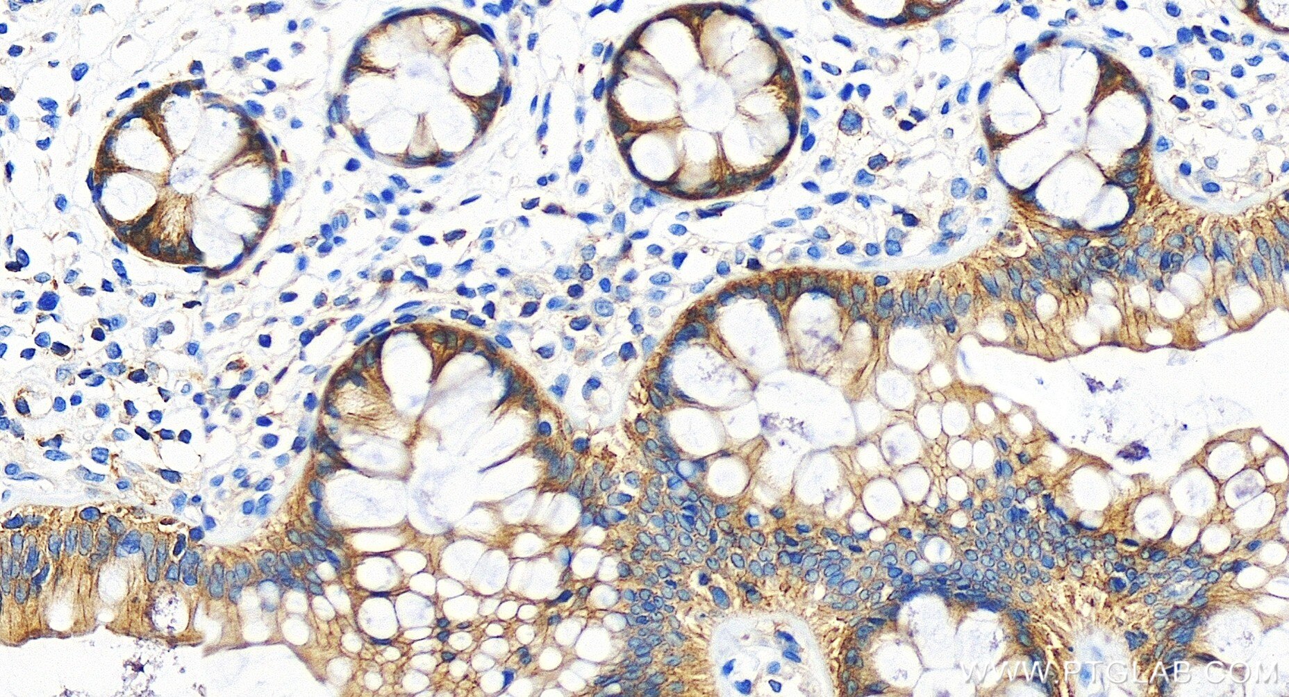 Immunohistochemistry (IHC) staining of human colon tissue using TNIK Recombinant antibody (84231-4-RR)