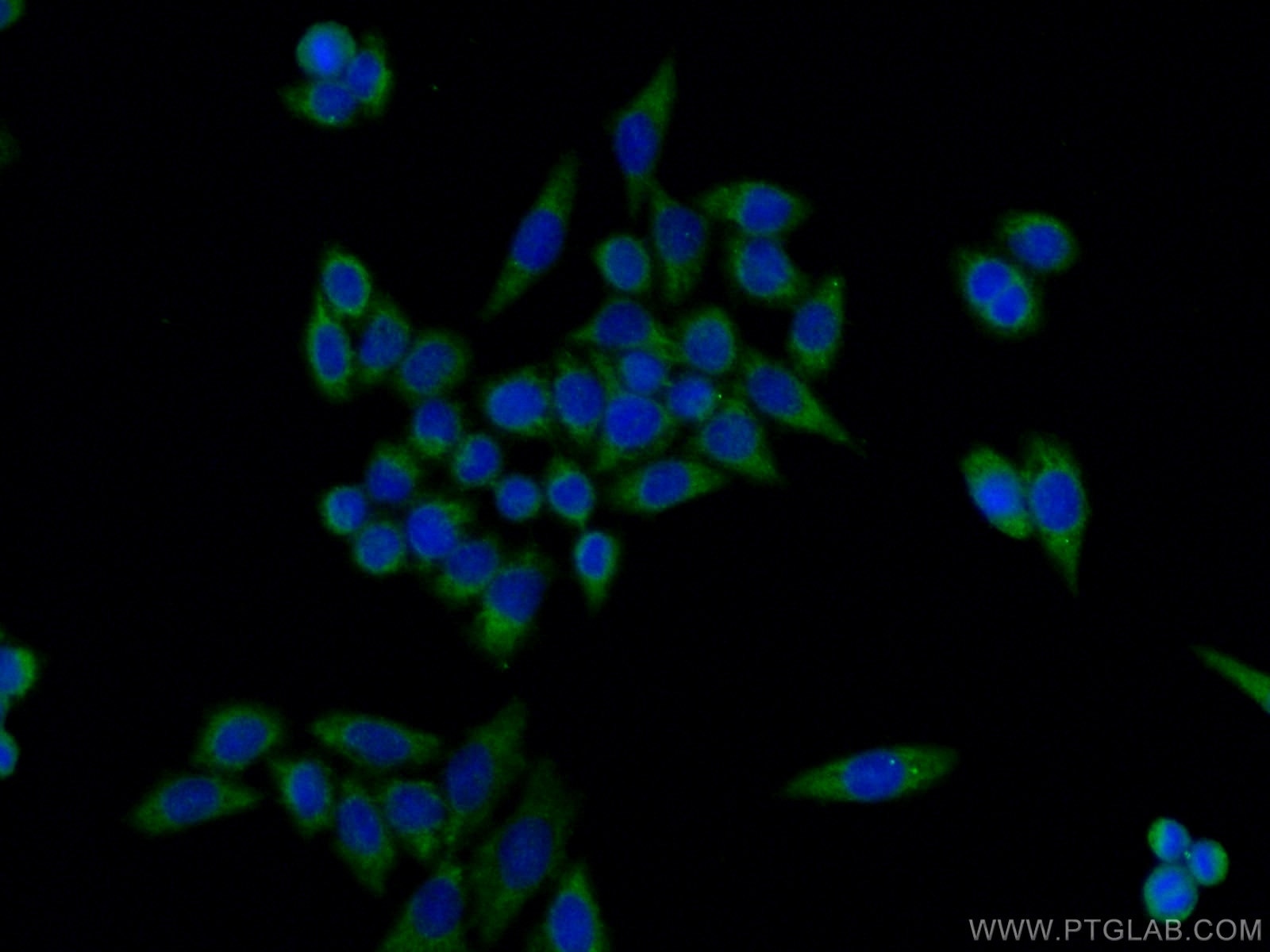 Immunofluorescence (IF) / fluorescent staining of HeLa cells using TNIP1 Polyclonal antibody (15104-1-AP)