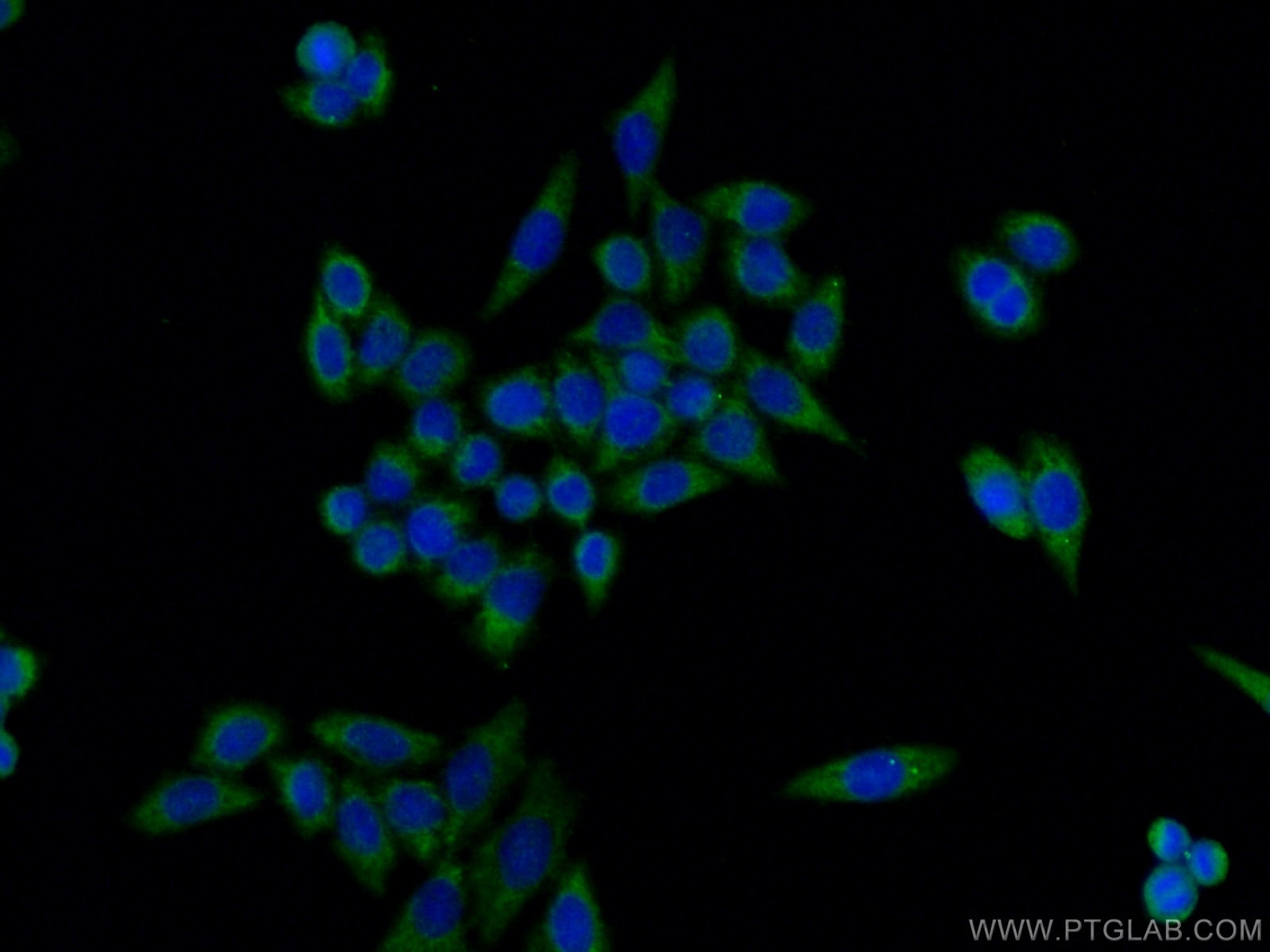 IF Staining of HeLa using 15104-1-AP