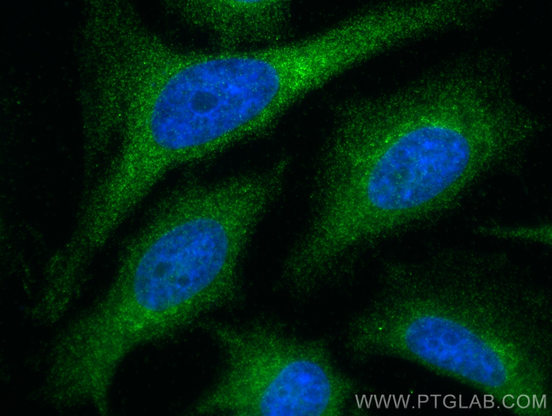 Immunofluorescence (IF) / fluorescent staining of HeLa cells using TNIP1 Polyclonal antibody (15104-1-AP)