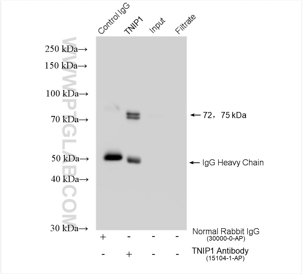 Immunoprecipitation (IP) experiment of HeLa cells using TNIP1 Polyclonal antibody (15104-1-AP)