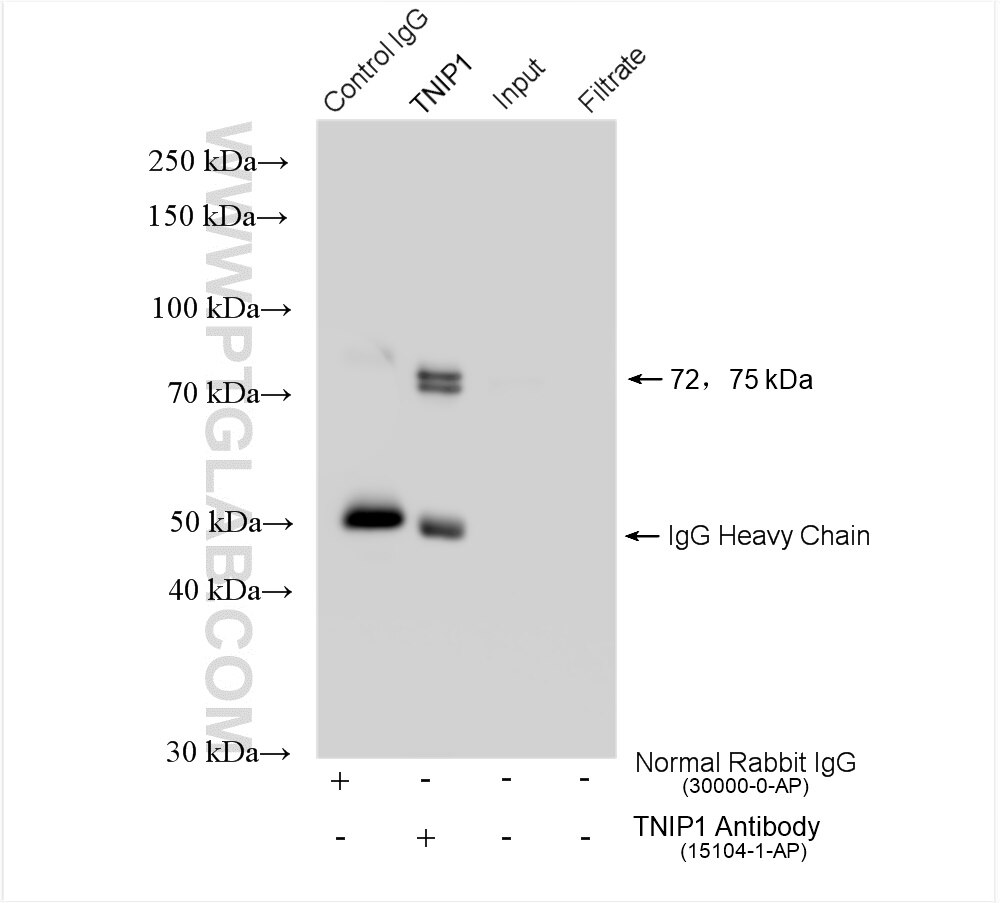 IP experiment of HeLa using 15104-1-AP