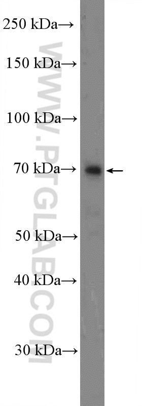 Western Blot (WB) analysis of mouse skeletal muscle tissue using TNIP1 Polyclonal antibody (15104-1-AP)