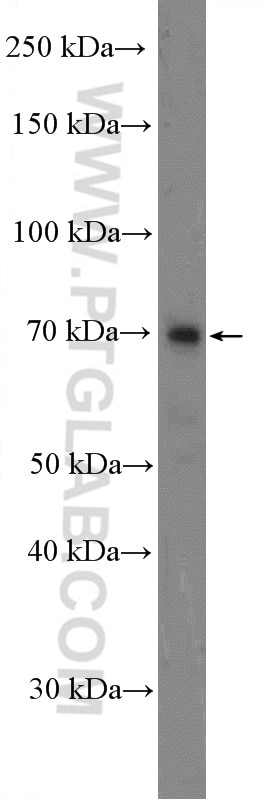 Western Blot (WB) analysis of mouse skeletal muscle tissue using TNIP1 Polyclonal antibody (15104-1-AP)