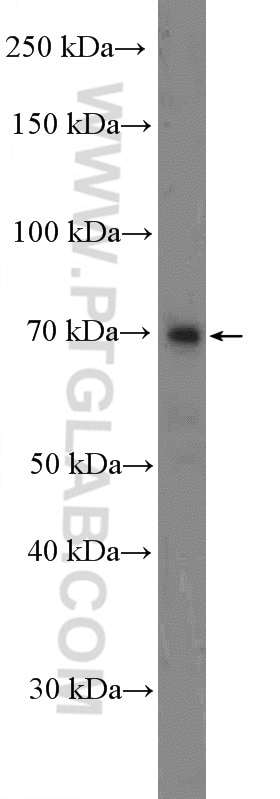 WB analysis of mouse skeletal muscle using 15104-1-AP