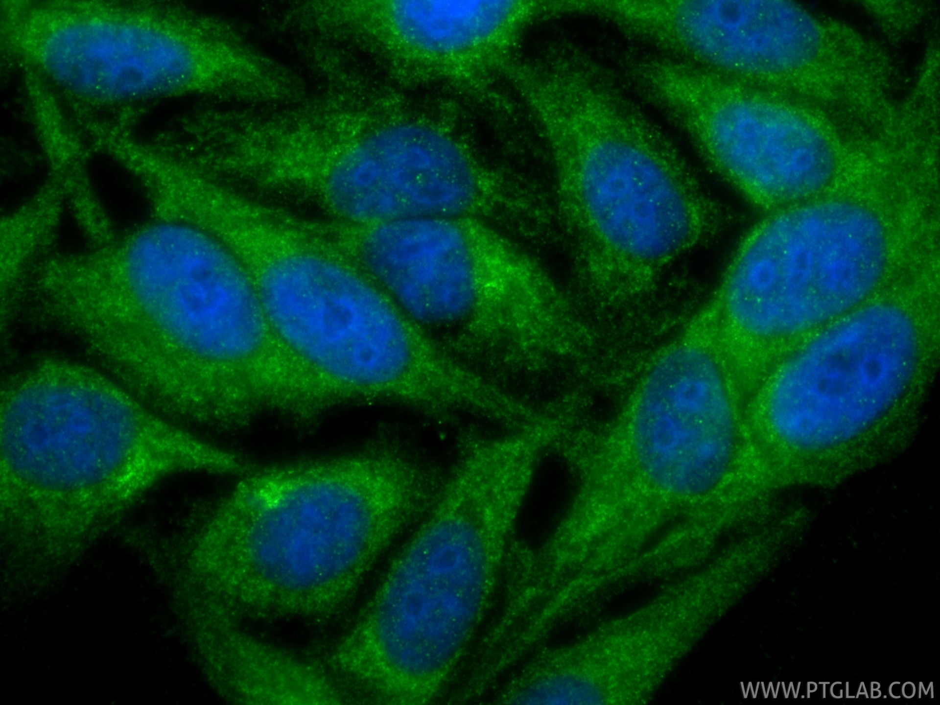 IF Staining of HepG2 using 15459-1-AP Immunofluorescence (IF) / fluorescent staining of HepG2 cells using TNIP2 Polyclonal antibody (15459-1-AP)