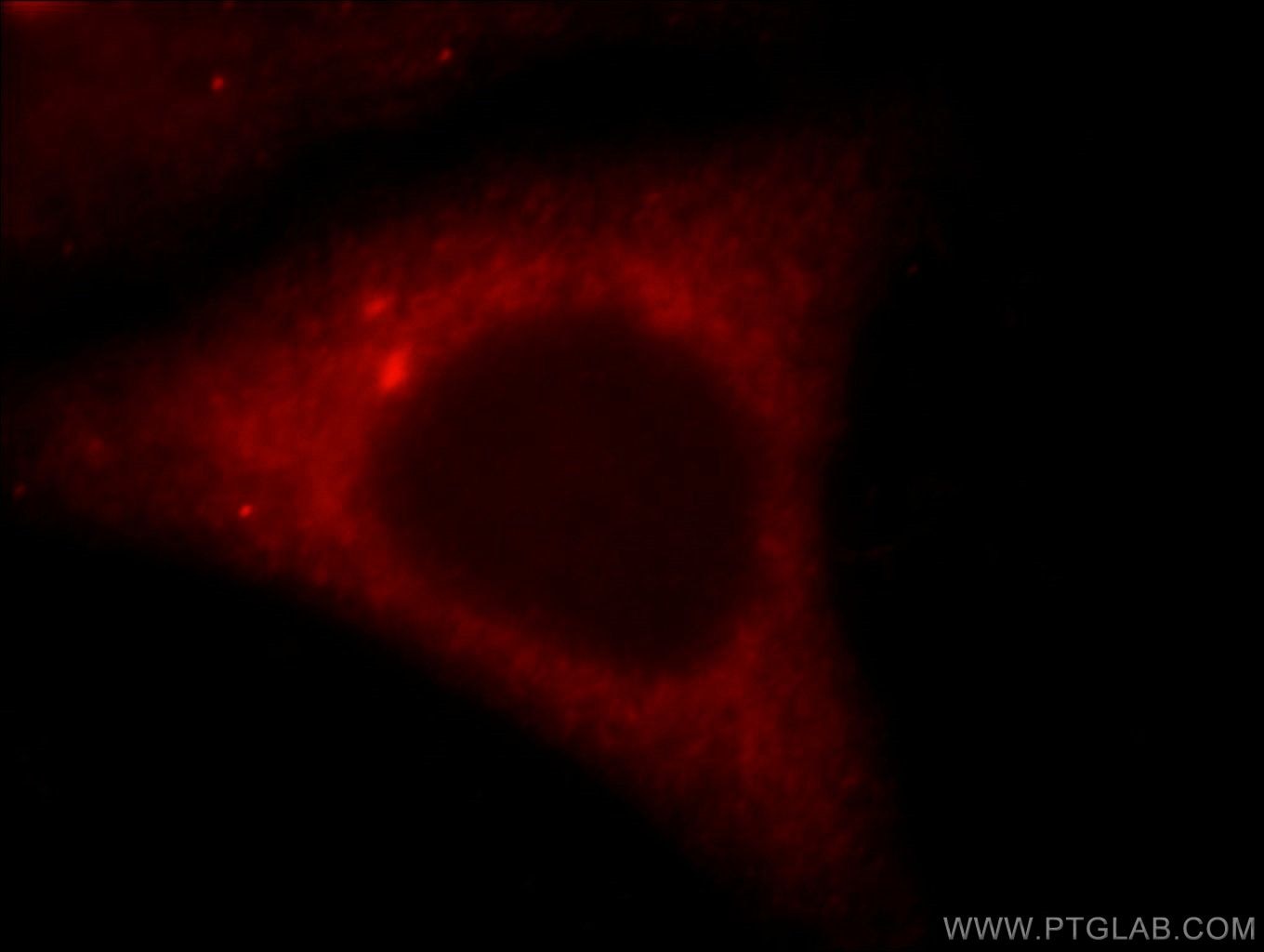 Immunofluorescence (IF) / fluorescent staining of HepG2 cells using TNIP2 Polyclonal antibody (15459-1-AP)