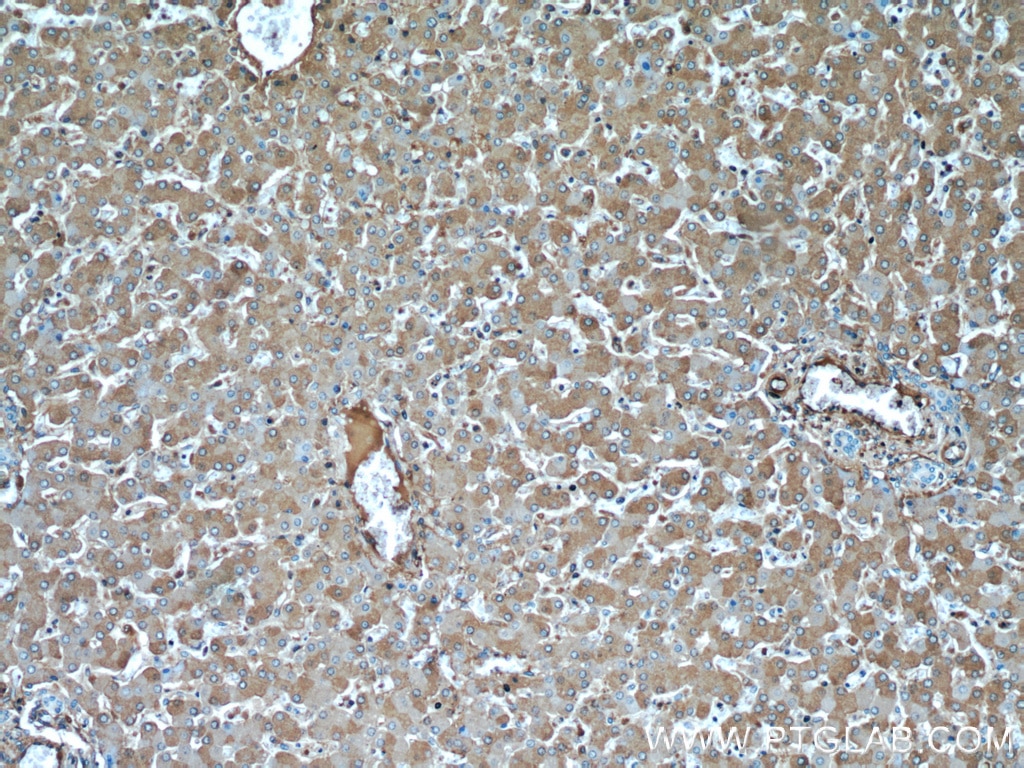 Immunohistochemistry (IHC) staining of human liver tissue using TNIP2 Polyclonal antibody (15459-1-AP)
