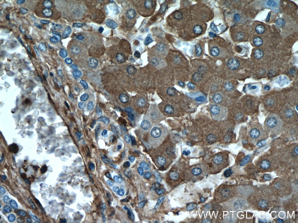 Immunohistochemistry (IHC) staining of human liver tissue using TNIP2 Polyclonal antibody (15459-1-AP)