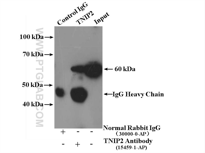 Immunoprecipitation (IP) experiment of HepG2 cells using TNIP2 Polyclonal antibody (15459-1-AP)