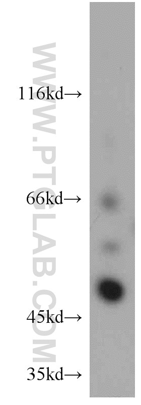 Western Blot (WB) analysis of mouse liver tissue using TNIP2 Polyclonal antibody (15459-1-AP)