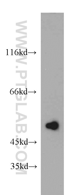 Western Blot (WB) analysis of HepG2 cells using TNIP2 Polyclonal antibody (15459-1-AP)
