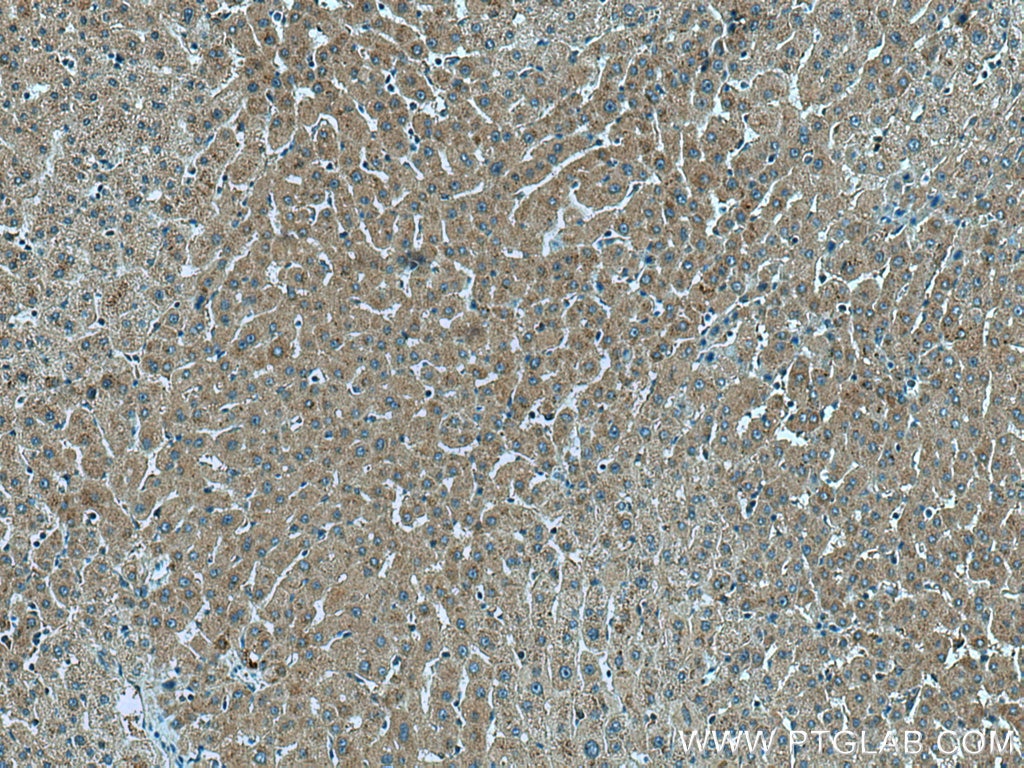 Immunohistochemistry (IHC) staining of human liver tissue using TNK1 Polyclonal antibody (14199-1-AP)