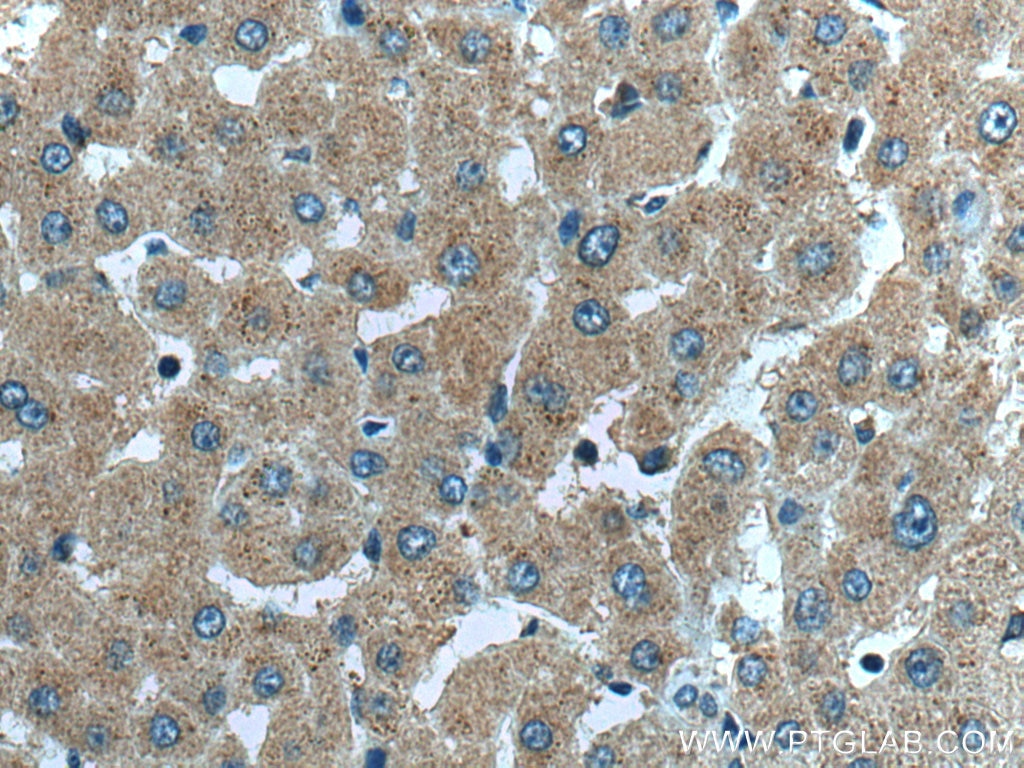 Immunohistochemistry (IHC) staining of human liver tissue using TNK1 Polyclonal antibody (14199-1-AP)