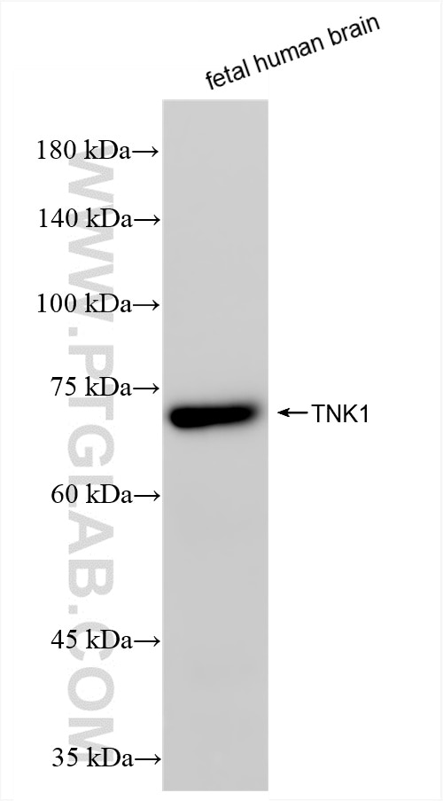 TNK1