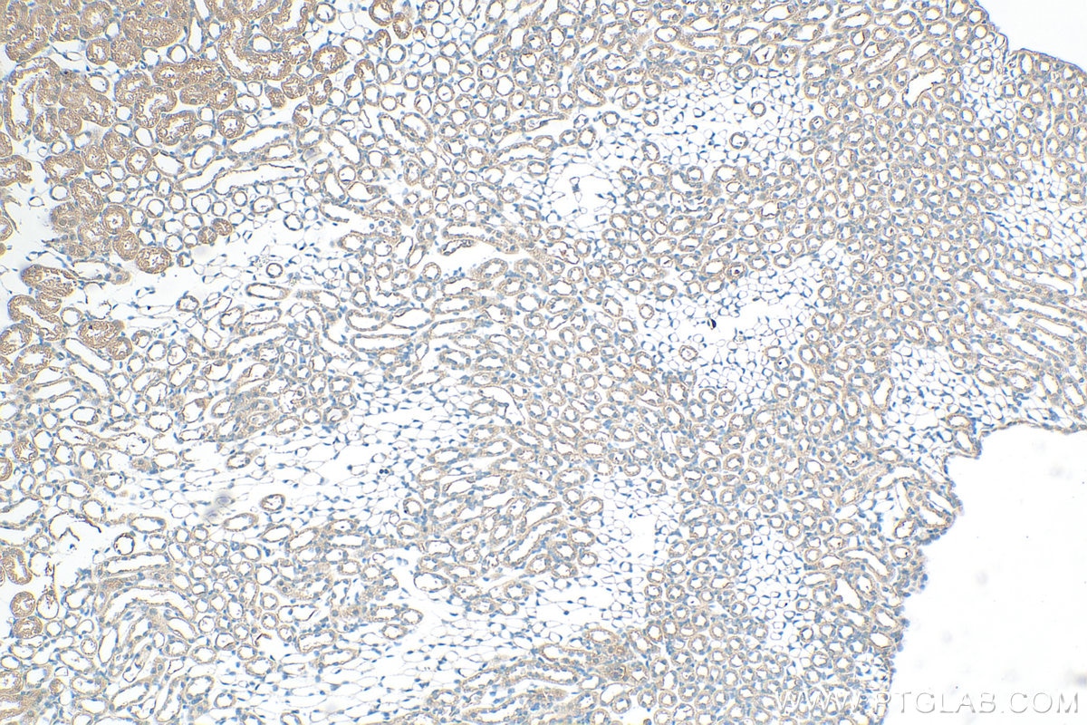 Immunohistochemistry (IHC) staining of mouse kidney tissue using ACK1 Polyclonal antibody (14304-1-AP)