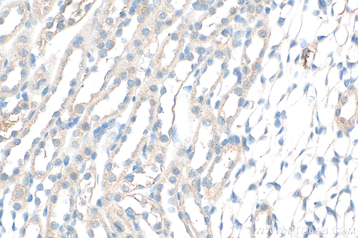 Immunohistochemistry (IHC) staining of mouse kidney tissue using ACK1 Polyclonal antibody (14304-1-AP)