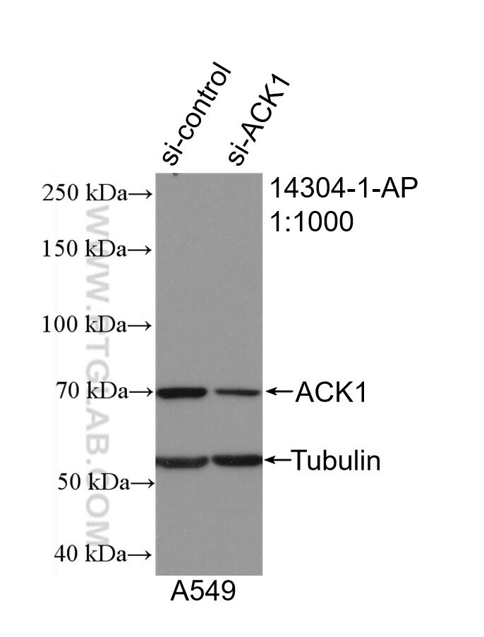 Western Blot (WB) analysis of A549 cells using ACK1 Polyclonal antibody (14304-1-AP)