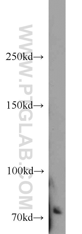 Western Blot (WB) analysis of HepG2 cells using ACK1 Polyclonal antibody (14304-1-AP)