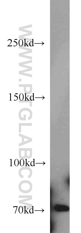 Western Blot (WB) analysis of SH-SY5Y cells using ACK1 Polyclonal antibody (14304-1-AP)