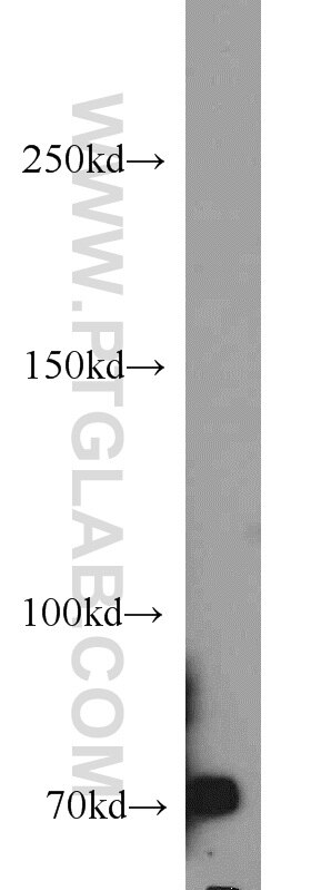 Western Blot (WB) analysis of HT-1080 cells using ACK1 Polyclonal antibody (14304-1-AP)