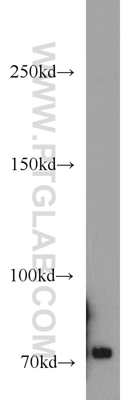 Western Blot (WB) analysis of A431 cells using ACK1 Polyclonal antibody (14304-1-AP)