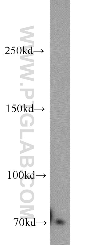 Western Blot (WB) analysis of mouse brain tissue using ACK1 Polyclonal antibody (14304-1-AP)