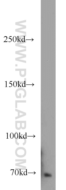 WB analysis of HeLa using 14304-1-AP